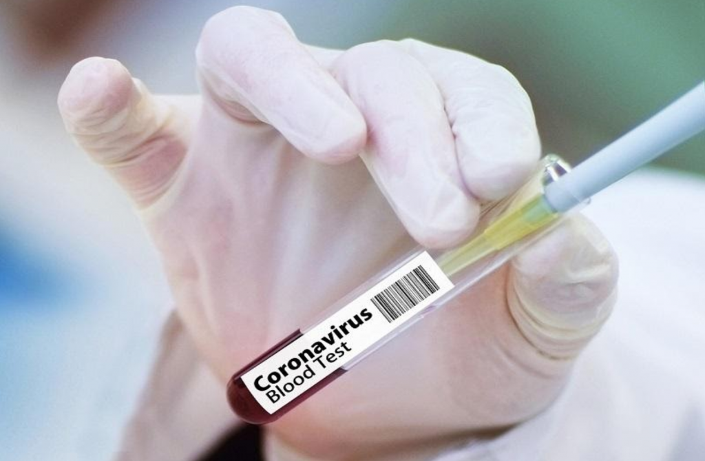 Coronavirus Blood Test